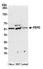PEPD Polyclonal Antibody
