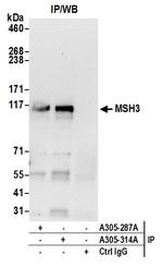 MSH3 Antibody in Immunoprecipitation (IP)