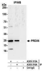 PRDX6 Antibody in Immunoprecipitation (IP)