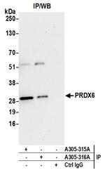 PRDX6 Antibody in Immunoprecipitation (IP)
