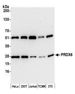 PRDX6 Antibody in Western Blot (WB)
