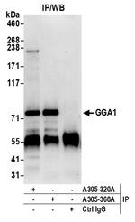GGA1 Polyclonal Antibody