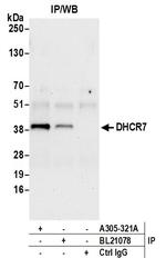 DHCR7 Polyclonal Antibody