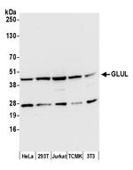 GLUL/Glutamine Synthetase Polyclonal Antibody