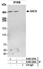 SACS Antibody in Immunoprecipitation (IP)