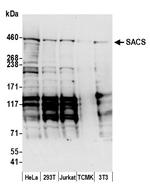 SACS Polyclonal Antibody