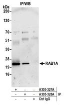 RAB1A Polyclonal Antibody
