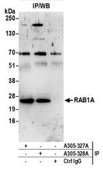 RAB1A Polyclonal Antibody