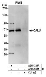 CALU Polyclonal Antibody