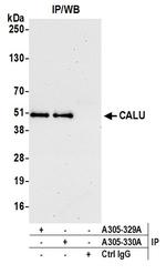 CALU Polyclonal Antibody