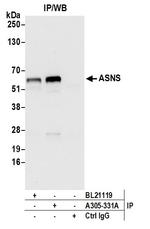 ASNS/Asparagine Synthetase Polyclonal Antibody