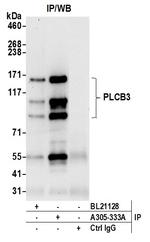 PLCB3 Antibody in Immunoprecipitation (IP)