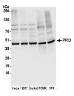 PPID Polyclonal Antibody