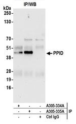 PPID Polyclonal Antibody