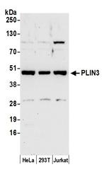 PLIN3 Polyclonal Antibody