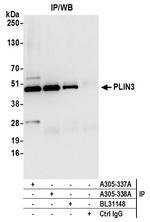 PLIN3 Polyclonal Antibody