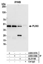PLIN3 Antibody in Immunoprecipitation (IP)