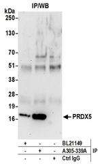 PRDX5 Antibody in Immunoprecipitation (IP)