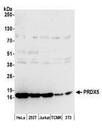 PRDX5 Polyclonal Antibody