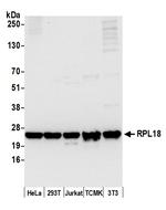 RPL18/Ribosomal Protein L18 Polyclonal Antibody