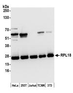 RPL18/Ribosomal Protein L18 Polyclonal Antibody