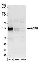 ASPH Polyclonal Antibody