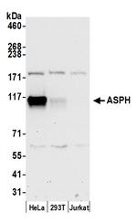 ASPH Polyclonal Antibody