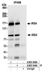 IRS4 Antibody in Immunoprecipitation (IP)