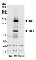 IRS4 Polyclonal Antibody