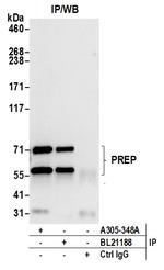 PREP/Prolyl Oligopeptidase Polyclonal Antibody