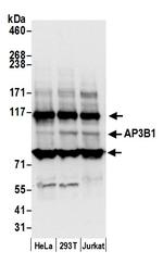 AP3B1 Polyclonal Antibody