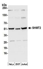 SHMT2 Polyclonal Antibody
