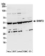 SHMT2 Polyclonal Antibody