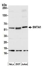 SNTA1 Polyclonal Antibody