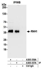 RNH1 Antibody in Immunoprecipitation (IP)