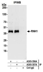 RNH1 Antibody in Immunoprecipitation (IP)