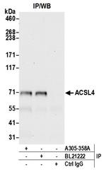 ACSL4/FACL4 Antibody in Immunoprecipitation (IP)