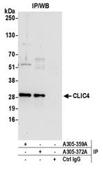 CLIC4 Antibody in Immunoprecipitation (IP)
