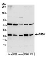 CLIC4 Polyclonal Antibody