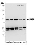 HAT1/KAT1 Polyclonal Antibody