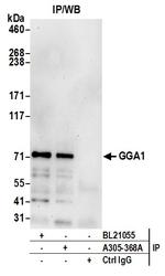 GGA1 Antibody in Immunoprecipitation (IP)