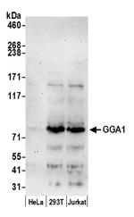 GGA1 Polyclonal Antibody