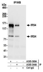 IRS4 Polyclonal Antibody