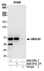 UBQLN2 Antibody in Immunoprecipitation (IP)