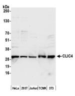 CLIC4 Polyclonal Antibody