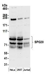 SPG20 Polyclonal Antibody