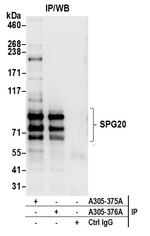 SPG20 Polyclonal Antibody