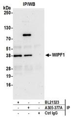WIPF1 Antibody in Immunoprecipitation (IP)