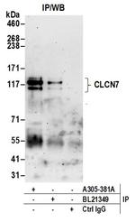 CLCN7 Polyclonal Antibody