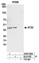 STX5 Polyclonal Antibody